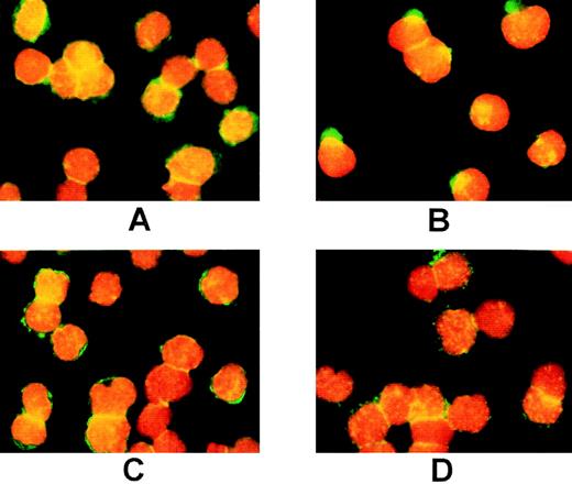 Fig. 2. Treatment with PP1 blocks capping of c-Kit. MO7e cells were preincubated without PP1 (A,B) or with PP1 (C,D) as described in Fig 1, then labeled with the 104D2 antibody. Before exposure to SCF (A,C), or after a 3-minute exposure to SCF (200 ng/mL; B,D), the cells were fixed and labeled with goat antimouse IgG-FITC plus propidium iodide, and photographed at a magnification of 60×.