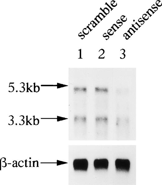 Fig. 10. Northern analysis of OCZF mRNA from antisense, sense, and scrambled ODN-2–treated bone marrow cells. Bone marrow cells were cultured with 10−8 mol/L 1,25(OH)2D3 and htROSCM for the formation of MNCs in the presence of 1 μmol/L OCZF ODN-2 for 4 days. RNA was isolated from the 4-day culture and approximately 1 μg of each sample was analyzed. Northern analysis was performed as described in Materials and Method. The same filter was rehybridized with a human β-actin probe as a control. Arrows indicate the 5.3- and 3.3-kb bands of OCZF and β-actin mRNA. Lanes correspond to RNA from scramble (lane 1), sense (lane 2), and antisense (lane 3) ODN-treated cells.