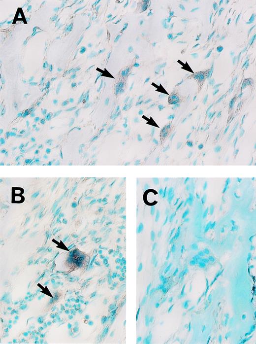 Fig. 2. Analysis of OCZF mRNA expression in osteoclasts from rat mandible by in situ hybridization. Sections were hybridized with a digoxygenin-labeled antisense (A and B) or sense (C) RNA probe. (A and B) The intense signal of OCZF mRNA is detectable in the osteoclasts with antisense RNA probe (the arrows). (C) No signal was observed in control experiment in which sense RNA was used in hybridization. (Original magnification × 239.)