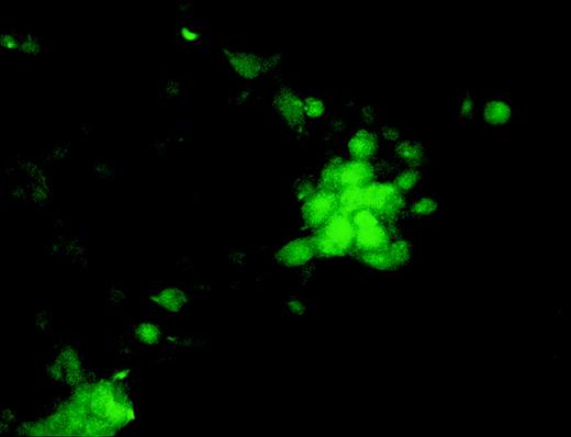 Fig. 6. Expression and detection of OCZF in human kidney cells.OCZF cDNA was inserted into an expression vector and transfected human kidney cells (293T) by the calcium phosphate-DNA coprecipitation method. After 48 hours, the cells were fixed and stained with MoAb Kat6 and FITC-labeled antimouse IgM. Dense staining was seen in the nuclei of some cells. (Original magnification × 202.)