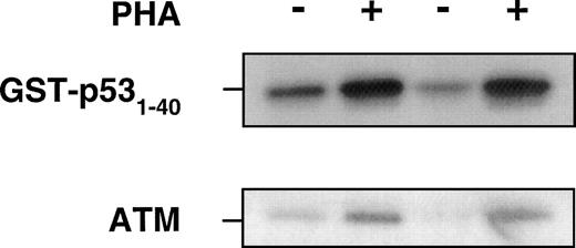 Fig. 4. Use of ATM immunoprecipitates to determine the effect of PHA on protein kinase activity, using GST-p53 (1-40) as a substrate for ATM kinase. PHA-treated or untreated PBMCs were collected after 72 hours of incubation at 37°C before preparation of lysates. The same amount of total protein was immunoprecipitated with anti-ATM antibody (Ab-3, Oncogene Research). The beads were washed with lysis buffer twice, once with 0.1 mol/L Tris-HCI, pH 7.5 containing 0.5 mol/L LiCl, and finally twice with kinase buffer. Reactions were performed in 25 μL containing 1 μg of GST-p53 (amino acids 1-40), 5 μCi of ATP-γ32-P in kinase buffer for 30 minutes at 30°C and analyzed for incorporation on SDS-PAGE. − and + refer to without and with PHA in PBMCs from two individuals. Immunoblotting with ATM-5BA antibody was used to detect ATM in the immunoprecipitates.