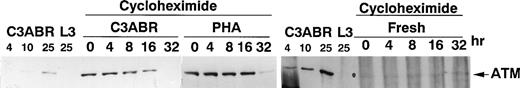 Fig. 7. Stability of ATM protein in PBMCs and lymphoblastoid cells. Cells were incubated in cycloheximide (25 μg/mL) for the times indicated before preparation of extracts for separation on SDS-PAGE and immunoblotting with ATM-3BA antibody. A total of 30 μg of protein was loaded for PHA-stimulated cells and for lymphoblastoid cells C3ABR, while 140 μg of protein was used for unstimulated PBMCs. Controls were included as in Fig 1. Exposure times differed among C3ABR, PHA-stimulated cells, and freshly isolated PBMCs.