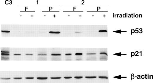 Fig. 8. Effect of ionizing radiation (6 Gy) on p53 and p21/WAF1 levels in freshly isolated (F) and PHA-stimulated (P) lymphocytes from 2 individuals. Cells were irradiated followed by incubation at 37°C in 5% CO2 for 2 hours before preparation of extracts. C3 represents extracts from unirradiated C3ABR cells. A total of 20 μg of protein was loaded in each lane of a 12% SDS-PAGE gel. β-actin was used as a loading control.