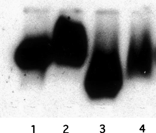 Fig. 7. Migration of defensin/125I-Lp(a) complexes on native gels. Unoxidized and oxidized 125I-Lp(a) (20 nmol/L) was incubated with defensin (HNP-1; 10 μmol/L) or buffer for 1 hour at 37°C, and the migration of the labeled lipoproteins towards the positive electrode on 0.5% agarose gels was analyzed using autoradiography. Lane 1, native Lp(a); lane 2, Lp(a)/defensin; lane 3, oxidized Lp(a); lane 4, oxidized Lp(a)/defensin.