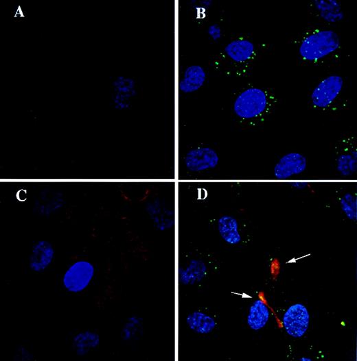 Fig. 10. Subcellular distribution of defensin, Lp(a), and Lp(a)/defensin complexes in HUVECs as assessed by confocal microscopy. HUVECs incubated with either Lp(a) (50 nmol/L; B) or defensin (10 μmol/L; C) or coincubated with defensin and Lp(a) (D) for 30 minutes at 37°C and then analyzed by confocal microscopy using polyclonal Lp(a) antibodies followed by FITC-conjugated antirabbit IgG (detected as green) and/or a monoclonal antihuman defensin followed by rhodamine TRITC-conjugated donkey antimouse IgG (detected as red). Normal rabbit IgGs served as control, as shown in (A). Cell nuclei were stained with DAPI (detected as blue). Colocalization of defensin and Lp(a) was assessed by double staining (D) and results in a yellow color (arrows).