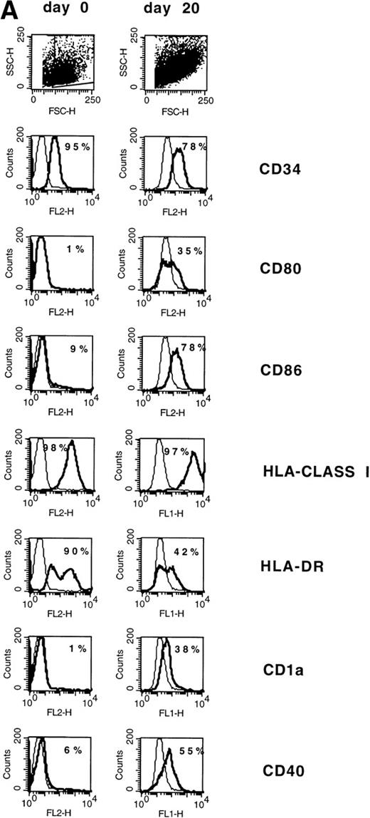 Fig. 1. (A) Phenotype of naive AML blasts and leukemia-derived DC (patient TA). Freshly thawed PBMC from an AML-M2 patient and the same cells after 20 days of culture in the presence of GM-CSF, TNF, and IL-4 were stained with fluorescein-or phycoerythrin-conjugated antibodies and analyzed by flow cytometry. To exclude debris, the viable cells were gated based on propidium iodide staining. Histograms represent the log of fluorescence (horizontal axis) versus the relative cell number (vertical axis). Thin lines represent the isotype-matched indifferent murine MoAb control. The number in each box represents the percent of positive cells. (B) CD80/HLA-DR coexpression on leukemia-derived DC (patient TA). Cells at day 20 of culture were double-stained with phycoerythrin-conjugated anti-CD80 MoAb (vertical axis) and anti-HLA-DR fluorescein-conjugated MoAb (horizontal axis). Fluorochrome-conjugated isotype-matched murine MoAbs (IgG1) were used as a negative control. The number in each quadrant represents the percentage of positive cells.
