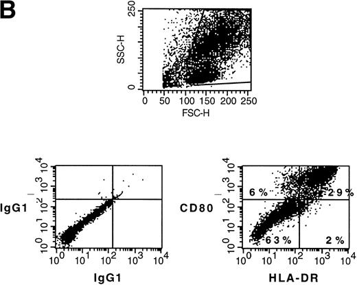 Fig. 1. (A) Phenotype of naive AML blasts and leukemia-derived DC (patient TA). Freshly thawed PBMC from an AML-M2 patient and the same cells after 20 days of culture in the presence of GM-CSF, TNF, and IL-4 were stained with fluorescein-or phycoerythrin-conjugated antibodies and analyzed by flow cytometry. To exclude debris, the viable cells were gated based on propidium iodide staining. Histograms represent the log of fluorescence (horizontal axis) versus the relative cell number (vertical axis). Thin lines represent the isotype-matched indifferent murine MoAb control. The number in each box represents the percent of positive cells. (B) CD80/HLA-DR coexpression on leukemia-derived DC (patient TA). Cells at day 20 of culture were double-stained with phycoerythrin-conjugated anti-CD80 MoAb (vertical axis) and anti-HLA-DR fluorescein-conjugated MoAb (horizontal axis). Fluorochrome-conjugated isotype-matched murine MoAbs (IgG1) were used as a negative control. The number in each quadrant represents the percentage of positive cells.