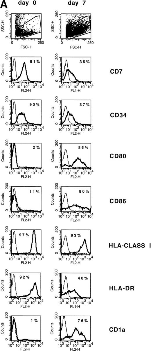 Fig. 4. (A) Phenotype of naive AML blasts and leukemia-derived DC (patient SC). Freshly thawed PBMC from an AML-M2 patient and the same cells after 7 days of culture in the presence of GM-CSF, TNF, and IL-4 were stained with fluorescein-or phycoerythrin-conjugated antibodies and analyzed by flow cytometry. To exclude debris, the viable cells were gated based on propidium iodide staining. Histograms represent the log of fluorescence (horizontal axis) versus the relative cell number (vertical axis). Thin lines represent the isotype-matched indifferent murine MoAb control. The number in each box represents the percentage of positive cells. (B) CD7/CD80 coexpression on naive AML blasts and leukemia-derived DC (patient SC). Cells at day 0 and day 7 of culture were double-stained with fluorescein-conjugated anti-CD7 MoAb (horizontal axis) and anti-CD80 phycoerythrin-conjugated MoAb (vertical axis). Fluorochrome-conjugated isotype-matched murine MoAbs (IgG1) were used as a negative control. The number in each quadrant represents the percentage of positive cells.