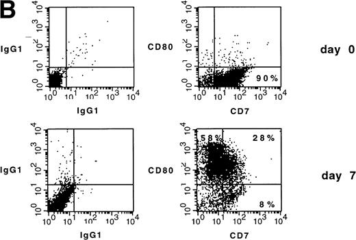Fig. 4. (A) Phenotype of naive AML blasts and leukemia-derived DC (patient SC). Freshly thawed PBMC from an AML-M2 patient and the same cells after 7 days of culture in the presence of GM-CSF, TNF, and IL-4 were stained with fluorescein-or phycoerythrin-conjugated antibodies and analyzed by flow cytometry. To exclude debris, the viable cells were gated based on propidium iodide staining. Histograms represent the log of fluorescence (horizontal axis) versus the relative cell number (vertical axis). Thin lines represent the isotype-matched indifferent murine MoAb control. The number in each box represents the percentage of positive cells. (B) CD7/CD80 coexpression on naive AML blasts and leukemia-derived DC (patient SC). Cells at day 0 and day 7 of culture were double-stained with fluorescein-conjugated anti-CD7 MoAb (horizontal axis) and anti-CD80 phycoerythrin-conjugated MoAb (vertical axis). Fluorochrome-conjugated isotype-matched murine MoAbs (IgG1) were used as a negative control. The number in each quadrant represents the percentage of positive cells.