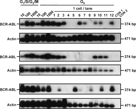 Fig. 3. BCR-ABL expression in G0 and G1/S/G2/M CD34+ cells isolated from CML patient samples no. 3 through 5. Controls included 1,000 G1/S/G2/M cells without RT (CON 1) and H2O blank (CON 2).