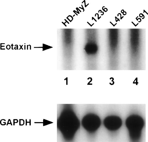 Fig. 3. Expression of the chemoattractant eotaxin in Hodgkin cell lines. Northern blot analysis of total RNA (30 μg) isolated from the Hodgkin cell lines HD-MyZ (lane 1), L1236 (lane 2), L428 (lane 3), and L591 (lane 4). The blot was hybridized with eotaxin- and subsequently with GAPDH-specific cDNA probes.
