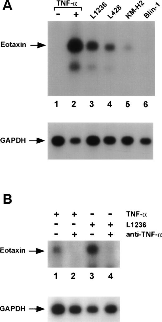 Fig. 4. Induction of eotaxin mRNA expression in normal human dermal fibroblasts. Northern blot analysis of total RNA (10 μg) isolated from fibroblasts. Blots were hybridized with eotaxin- and subsequently with GAPDH-specific probes. (A) Untreated fibroblasts (lane 1), fibroblasts after stimulation with 30 ng/mL TNF- (lane 2), and fibroblasts after cocultivation with the Hodgkin cell lines L1236 (lane 3), L428 (lane 4), KM-H2 (lane 5), and the pre-B–cell line Blin-1 (lane 6). (B) Fibroblasts after stimulation with 10 ng/mL TNF- (lanes 1 and 2) and incubation with anti–TNF- antibodies (lane 2). Fibroblasts after cultivation in supernatant of the Hodgkin cell line L1236 (lanes 3 and 4) and incubation with anti–TNF- antibodies (lane 4).
