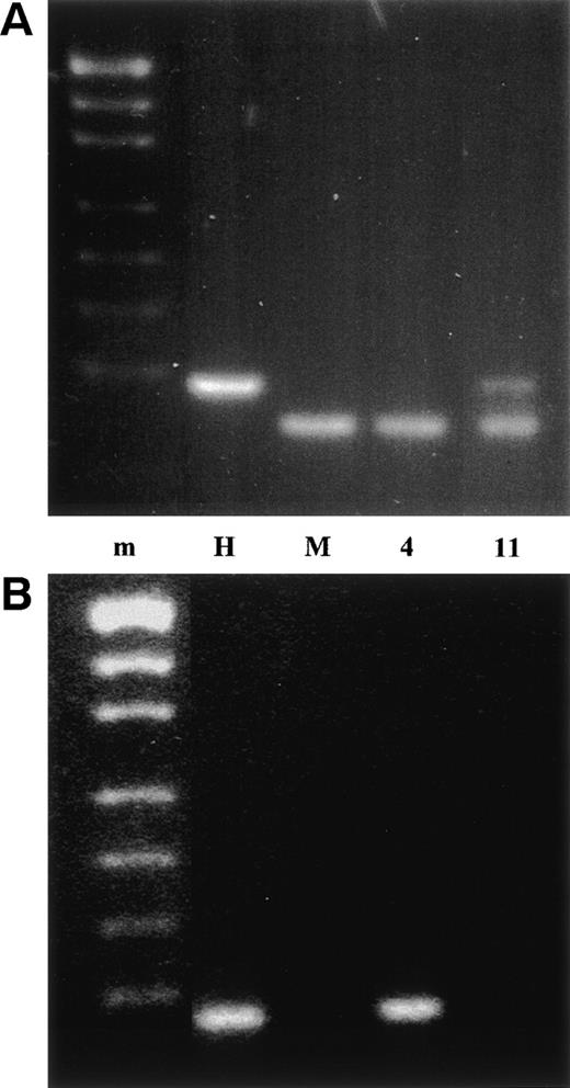 Fig. 2. PCR analysis of the der(4) and der(11) containing somatic cell hybrids. m is the pUC19/Hpa II molecular weight marker, H is normal human, M is mouse, 4 is the der(4) hybrid, and 11 is the der(11) hybrid. (A) NUP98 exon B PCR product digested withTaq I. Mouse and human NUP98 cDNA sequences are highly conserved and the exon B PCR also amplified mouse NUP98. The mouse and human exon B PCR products were distinguished by a TaqI restriction site, which is present in the mouse product but absent in the human product. (B) NUP98 exon C PCR product.