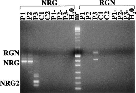 Fig. 4. RT-PCR analysis of NRG and RGN fusion transcripts in 3 t(4;11)(q21;p15) patients. P1, P2, and P3 are RT-PCR products from peripheral blood mononuclear cells from the patients. C1 and C2 are RT-PCR products from peripheral blood mononuclear cells of normal donors. Samples marked with a minus sign are negative control RT-PCRs without reverse transcriptase. H2O controls are negative control RT-PCRs without target. The lane marked m contains both SPP1/EcoRI and pUC19/Hpa II molecular weight markers. The most prominent bands in the RGN PCR of patient no. 3 are alternative splicings of RGN with and without exon B.