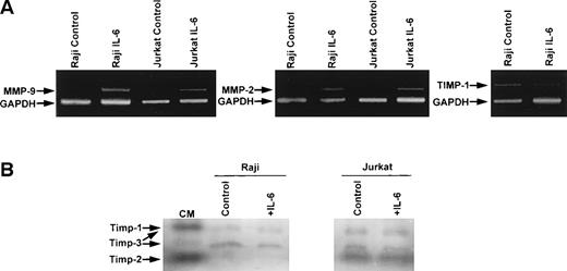 Fig. 4. RT-PCR and reverse zymographic analyses of RNA extracted from Raji and Jurkat cells and media conditioned by Raji and Jurkat cell lines stimulated with IL-6. (A) RNA extracted from Raji and Jurkat cell lines was analyzed for the expression of MMP-9, MMP-2, and TIMP-1 by RT-PCR as described in the Materials and Methods. Cells were cultured in serum-free media with and without IL-6 (100 ng/mL). Each analysis was internally controlled by inclusion of GAPDH primers. (B) Reverse zymogram of conditioned media from Raji and Jurkat cell lines stimulated 100 ng/mL IL-6. Conditioned medium (CM) from BHK cells was used as a positive control for TIMP activities.