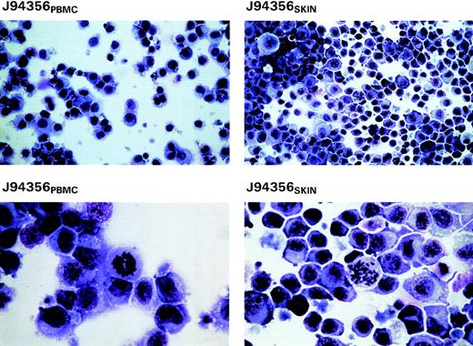 Fig. 3. Giemsa stains of cytospin preparations from the 2 cell lines derived from blood and skin of animal J94356 (J94356PBMC and J94356SKIN, respectively) after 2 months in culture in RPMI with 10% FBS and 20 U/mL of IL-2. High-magnification views (lower panels) show the pleomorphic appearance of these cells with myeloid-like features and presence of mitotic figures.