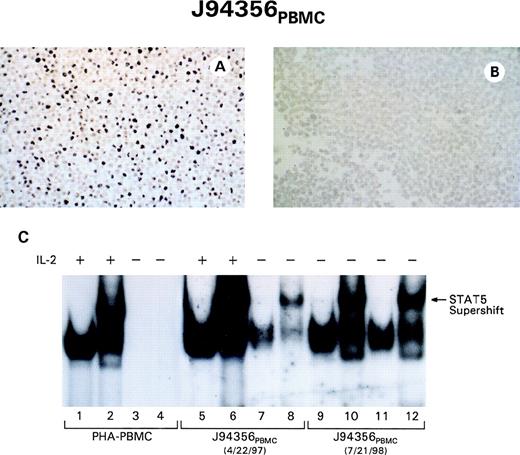 Fig. 9. The transition of the J94356PBMC expressing HVMNE cell lines to IL-2 independence is associated with STAT5 activation and HVMNE expression. J94356PBMC cells hybridized with EBER RNA (A) or incubated with hybridization buffer in the absence of probe (B). (C) EMSA on control PBMC (lanes 1 through 4) and the J94356PBMCcell line in the IL-2–dependent (lanes 5 through 8) and IL-2–independent (lanes 9 through 12) status.