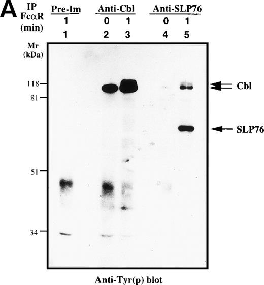 Fig. 4. Characterization of Cbl-SLP-76 interaction in U937IF cells. We examined the tyrosine phosphorylation of Cbl and SLP-76 in U937IF cells under conditions of anti-FcR (A77) stimulation. (A) Antiphosphotyrosine blot performed on anti-Cbl and anti–SLP-76 immunoprecipitates. Lane 1 is a preimmune immunoprecipitate. Anti-Cbl immunoprecipitation was performed from resting U937IF cells (lane 2) and from U937IF stimulated with anti-FcR and RM (lane 3). Anti–SLP-76 immunoprecipitates of resting (lane 4) and U937IF cells stimulated with anti-FcR and RM for 1 minute (lane 5). (B) Anti-Cbl (upper panel) and anti–SLP-76 (lower panel) immunoblots performed on the same membrane of (A) after stripping with 0.1 mol/L glycine, pH 2.5, at room temperature for 30 minutes. Lanes are identical to those in (A).