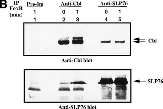 Fig. 4. Characterization of Cbl-SLP-76 interaction in U937IF cells. We examined the tyrosine phosphorylation of Cbl and SLP-76 in U937IF cells under conditions of anti-FcR (A77) stimulation. (A) Antiphosphotyrosine blot performed on anti-Cbl and anti–SLP-76 immunoprecipitates. Lane 1 is a preimmune immunoprecipitate. Anti-Cbl immunoprecipitation was performed from resting U937IF cells (lane 2) and from U937IF stimulated with anti-FcR and RM (lane 3). Anti–SLP-76 immunoprecipitates of resting (lane 4) and U937IF cells stimulated with anti-FcR and RM for 1 minute (lane 5). (B) Anti-Cbl (upper panel) and anti–SLP-76 (lower panel) immunoblots performed on the same membrane of (A) after stripping with 0.1 mol/L glycine, pH 2.5, at room temperature for 30 minutes. Lanes are identical to those in (A).