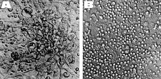 Fig. 2. Photomicrograph of lymphocyte proliferation in response to control (A) and mPEG-derivatized (B: 1.2 mmol/L mPEG/4 × 106 PBMC) stimulator PBMC. In (B), the PBMC remain small and rounded, a morphological feature characteristic of resting, nonproliferative lymphocytes, whereas in (A), the PBMC are larger and exhibit stellate protrusions typical of antigen-stimulated cells. Shown is the response of donor 4 to donor 1 (stimulator).