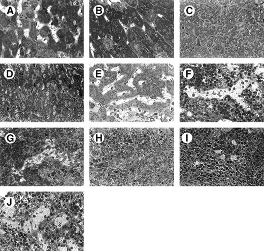 Fig. 6. Histopathologic analysis demonstrates no reduction in lysosomal storage in the liver (A) or spleen (F) 24 hours after injection of peritoneal macrophages. A dramatic decrease in lysosomal storage is observed in the liver 7 (B), 15 (C), and 30 (D) days after injection. A similar reduction in storage is observed in the spleen 7 (G), 15 (H), and 30 (I) days after injection. Progenitor-derived macrophages provide an equivalent level of correction. The histopathological appearance of the liver (E) and spleen (J) from an untreated age-matched MPS VII mouse is shown. (Original magnification × 242.)
