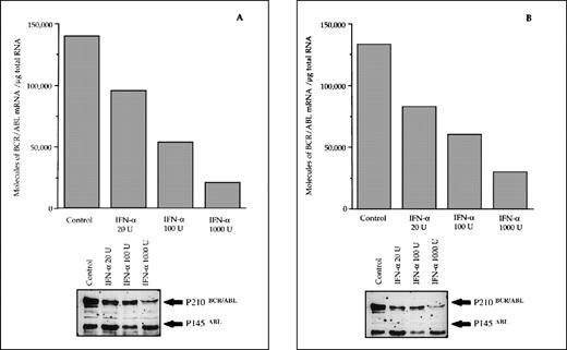 Fig. 4. Differential effects of IFN- priming on BCR/ABL expression in bone marrow mononuclear cell cultures from CML patients (A and B, IFN- responder patients; C, IFN-–resistant patient; D, a patient presenting in initial blastic transformation). Bone marrow mononuclear cells were cultured for 24 hours with the indicated concentrations (U/mL) of IFN-. Lower panels: Western blot for intracellular P210BCR/ABLcontent, including P145ABL determination used as an internal control.