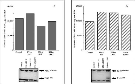 Fig. 4. Differential effects of IFN- priming on BCR/ABL expression in bone marrow mononuclear cell cultures from CML patients (A and B, IFN- responder patients; C, IFN-–resistant patient; D, a patient presenting in initial blastic transformation). Bone marrow mononuclear cells were cultured for 24 hours with the indicated concentrations (U/mL) of IFN-. Lower panels: Western blot for intracellular P210BCR/ABLcontent, including P145ABL determination used as an internal control.