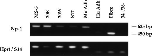 Fig. 4. Expression pattern of the neuropilin-1 gene. RT-PCRs were performed using total RNA isolated from stromal cell lines (MS-5, 30E, 30W, and S17), adherent layers of long-term murine and human cultures (Mo Adh and Hu Adh), human fibroblasts (Fibro), and human CD34+/CD38− (34+/38−) hematopoietic primitive cells. PCR products are 450 bp for human neuropilin-1 and 635 bp for murine neuropilin-1. As a control, amplification of RT products with either S14 primers (human samples) or HPRT primers (murine samples) is shown.
