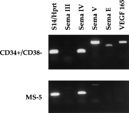 Fig. 8. Differential expression of secreted semaphorins and VEGF 165. RT-PCRs were performed using total RNA from human CD34+/CD38− cells and from murine MS-5 cells (see Materials and Methods). Expected PCR products are 130 bp for human semaphorin IV, 430 bp for human semaphorin III, 410 bp for human semaphorin V, 255 bp for human and murine semaphorin E, 260 bp for VEGF 165, 260 bp for murine semaphorin IV, 720 bp for murine semaphorin V, and 530 bp for murine semaphorin III. Controls consist of amplification with either S14 primers (human samples) or HPRT primers (murine samples).