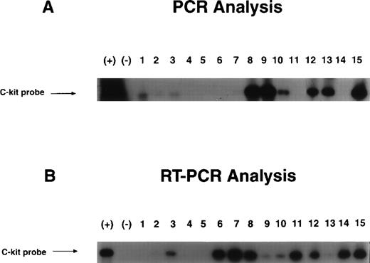 Fig. 7. Examples of integration and expression of transducedc-kit cDNA by PCR (A) and RT-PCR (B) analysis. Sorted single CD34+++kit++ and kit+cells were prestimulated, transduced with c-kit cDNA or mock control viruses, and growth in the presence of cytokine combination as described in Materials and Methods. Individual BFU-E colonies were removed and DNA and RNA were extracted for PCR and RT-PCR analysis. The PCR generates a 959-bp fragment.