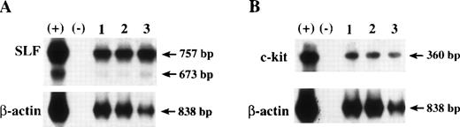 Fig. 9. Examples of expression of SLF (A) and c-kit (B) by RT-PCR in c-kit subsets of CD34+++ cells in 1 representative of 4 experiments. RNA was extracted from cells and reverse transcription was performed. PCR for SLF was performed using a pair of primers as described in Materials and Methods, which generate 757-bp and 673-bp products, respectively, representing soluble and membrane-bound SLF (A). PCR analysis for c-kit was performed using a pair of primers as described in Materials and Methods, which generates a 360-bp product (B). β-Actin, used as internal control, was performed using a pair of primers as described in Materials and Methods, and generates an 838-bp product. RNA extracts from human stromal cells (NFF) were used as positive control (+), and PCR reaction reagents were used as negative control (−). Lanes 1 through 3 are samples from CD34+++kit++, kit+, and kitLo/−cells, respectively.
