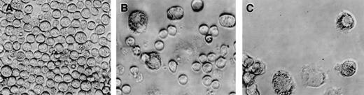 Fig. 8. Phenotypic appearance of single cell clonal assays at 2 weeks by inverted scope. (A) Mast cell colony. (B) Mixed mast cell/monocyte colony. (C) Monocyte colony.