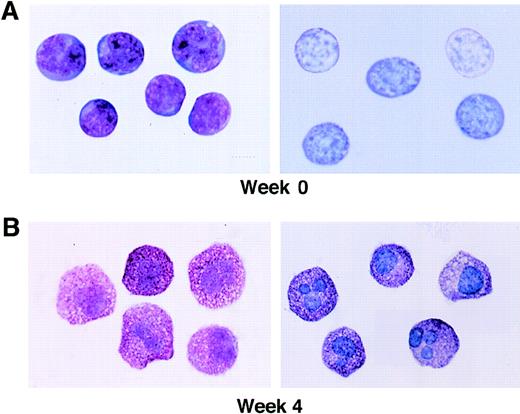 Fig. 4. Wright-Giemsa staining and metachromasia of CD34+/ c-kit+/CD13+cells at 0 weeks (A), as well as mast cells at 4 weeks (B). Left panels show light microscopy of Wright-Giemsa–stained cells. Right panels show acid toluidine blue–positive cells (original magnification × 1,000).