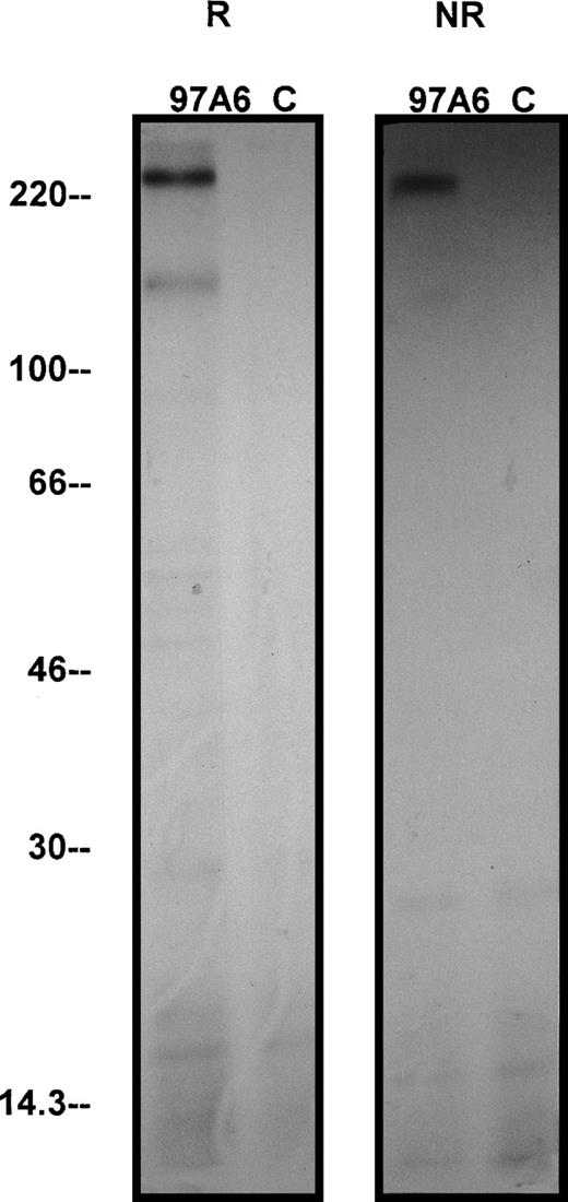 Fig. 8. Immunoprecipitation of the 97A6 reactive antigen. 107 KU-812 cells were surface-iodinated with125I-iodine by the lactoperoxidase method and immunoprecipitated under reduced and nonreduced conditions with 97A6 antibody-coated beads or control beads, respectively. The precipitates were then separated by 5% to 15% SDS-PAGE and visualized by radiographic photography. “R” indicates reduced conditions; “NR” indicates nonreduced conditions. Molecular weight standards are indicated on the left.