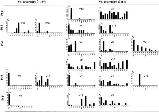 Fig. 4. Southern blot analysis of PCR-amplified Vβ-Jβ segments in FHL patients. The amplified products were respectively hybridized with each V fragment probe. *Underlining shows a Vβ gene with high frequency (15%). Preferential Jβ usage in highly frequent Vβ families is observed.