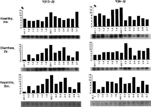 Fig. 6. Jβ usage of Vβ13 or Vβ6 in control infants. Both Vβ6 and Vβ13 generally used a variety of 13 Jβ genes with a bias for Jβ2; the average Jβ1:Jβ2 ratios as a whole were 42:58 for Vβ6 and 33:67 for Vβ13. There was no Jβ gene usage greater than 20%.