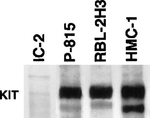 Fig. 2. Immunoblot analysis of tyrosine phosphorylation of the c-kit receptor. Marked positive reaction is observed in P-815, RBL-2H3, and HMC-1 cells, but not in the original IC-2 cells.