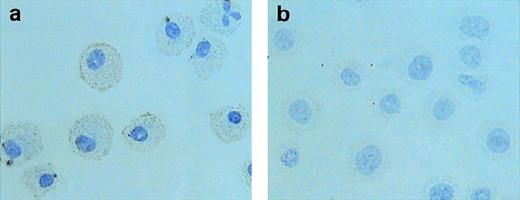Fig. 5. Immunocytochemical staining for MMP-9. BMCMCs incubated with rIL-3 (a) or with 100 ng/mL rSCF (b) for 72 hours were fixed in 4% paraformaldehyde and treated with anti–MMP-9 antibody. BMCMCs incubated with rSCF show a weak reaction or no reaction for MMP-9.