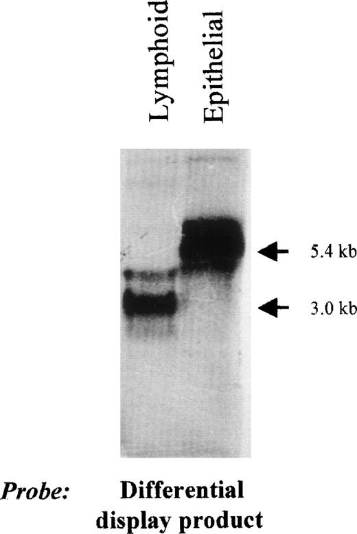 Fig. 1. Northern analysis of transcripts identified by the lymphoid differential display product. Total RNAs (20 μg) from an EBV-transformed lymphoblastoid line (Laz388) and a small cell lung cancer cell line (NCIH345) were size fractionated, blotted, and hybridized with the radiolabeled differential display fragment. The major transcripts in the epithelial and lymphoid cell lines were ≈5.4 kb and ≈3 kb, respectively.