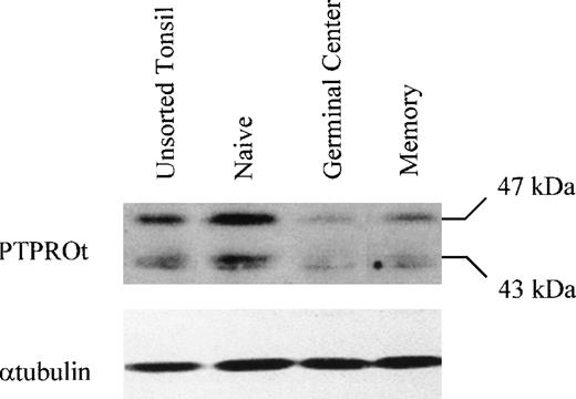 Fig. 8. PTPROt expression in normal naive quiescent, germinal center, and memory B cells. Whole-cell lysates (75 μg) from unsorted tonsillar B cells and highly purified naive (CD19+sIgD+ CD38−), germinal center (CD19+ sIgD− CD38+), and memory (CD19+ sIgD− CD38−) B cells were immunoblotted and analyzed with the antiserum directed against the murine PTPROt homologue, PTPØ. The abundance of PTPROt in naive, germinal center, and memory B cells was compared by scanning densitometry. Autoradiograms were scanned with a CCD camera linked to a frame grabber (Alpha Imager 2000; Alpha Innotec Corp, San Leandro, CA) and band intensities were quantified by using Image Quant Software (Molecular Dynamics, Sunnyvale, CA). The filters were also probed with an antitubulin antibody to assure equal loading.