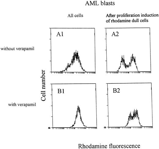 Fig. 6. Two examples of rhodamine content (A and C) in AML blasts after the rhodamine efflux assay with (2) or without (1) verapamil in the efflux medium. Efflux inhibition by verapamil caused a higher cellular rhodamine content predominantly in the RhoD cells. RhoD blasts were sorted and triggered to proliferate by exposure to HGFs for 48 hours. Effective proliferation induction resulted in an increase of cellular rhodamine content (A2 and C2). In these samples, only a subpopulation of the blasts became rhodamine bright after proliferation induction. Efflux modulation by verapamil was negligible in the rhodamine bright cells. The persisting rhodamine dull cells kept their sensitivity to efflux modulation by verapamil (B2 and D2).