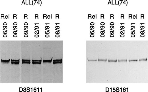 Fig. 2. LOH as clonal marker in ALL. PCR analysis in 1 B-ALL case (74) detected identical LOH patterns in leukemic cell DNA in 2 consecutive relapses (lanes 06/90 and 05/91, respectively). This was observed with 2 different microsatellite markers, respectively, on chromosome 3 (D3S1611) and 15 (D15S161). R, remission; Rel, relapse.