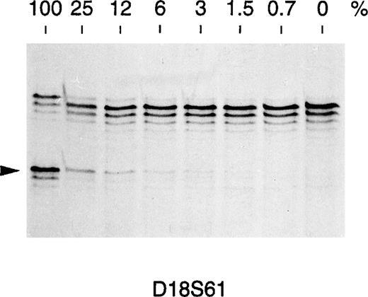 Fig. 4. Sensitivity of the PCR-based assay in detecting microsatellite alterations. Two DNAs from healthy donors (A and B) showing a different allele for the D18S61 marker (arrowed) were mixed at the indicated percent to obtain a constant final amount of 100 ng DNA as a PCR template. A content of 3% of the donor B DNA showing the lower allele is required for a faint band to appear in the autoradiography. This corresponds to a sensitivity of about 1.5% novel allele DNA in a given sample under these PCR conditions.