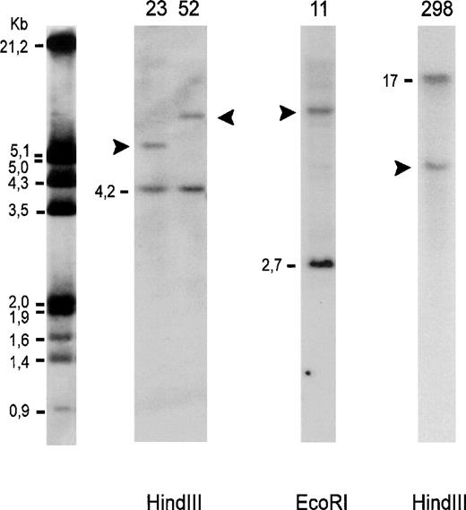 Fig. 5. Southern blot analysis of genomic DNA. Autoradiography after hybridization with 32P-labeled DNA probes for detection of bcl-2 gene rearrangements in major (lanes 23, 52, 11) and minor breakpoint region (lane 298). Lanes 23, 52: follicle center lymphomas; lane 11: diffuse large B-cell lymphoma; lane 298: mantle cell lymphoma. Dashes indicate the germline bands and arrowheads the rearranged fragments. The molecular-weight marker is indicated on the left.