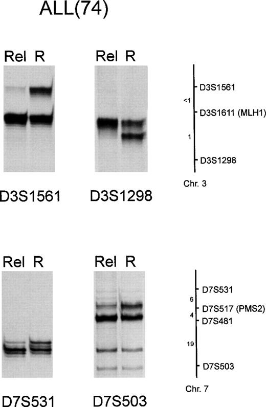 Fig. 7. LOH involving loci flanking D3S1611(MLH1) and D7S517 (PMS2) in ALL patient 74. Genomic DNA was PCR-amplified for microsatellites D3S1561, D3S1298, D7S531, and D7S503, as reported in Materials and Methods. R, remission; Rel, relapse. A schematic chromosome map indicating the location of the markers used and their approximate distances in centimorgans is also shown.28 Marker D7S481 was not informative in patient 74 (data not shown).