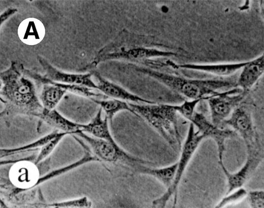 Fig. 7. Transformation of NIH 3T3 fibroblasts by constitutively active M-Ras G22V. (A) NIH 3T3 fibroblasts were retrovirally transduced with (a) empty vector, (b) N-Ras Q61K, (c) M-Ras wt, or (d) M-Ras G22V. Shown are phase-contrast photomicrographs of cells grown in medium containing 10% calf serum. (B) Cell densities reached by polyclonal populations of NIH3T3 cells expressing vector alone (◊), M-Ras wt (□), M-Ras G22V (•), and N-Ras Q61K (▴). Cells were grown in 10% calf serum and figures represent data from 2 independent experiments, each performed in triplicate, and are shown as means ± SD.