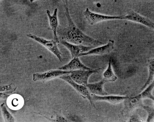 Fig. 7. Transformation of NIH 3T3 fibroblasts by constitutively active M-Ras G22V. (A) NIH 3T3 fibroblasts were retrovirally transduced with (a) empty vector, (b) N-Ras Q61K, (c) M-Ras wt, or (d) M-Ras G22V. Shown are phase-contrast photomicrographs of cells grown in medium containing 10% calf serum. (B) Cell densities reached by polyclonal populations of NIH3T3 cells expressing vector alone (◊), M-Ras wt (□), M-Ras G22V (•), and N-Ras Q61K (▴). Cells were grown in 10% calf serum and figures represent data from 2 independent experiments, each performed in triplicate, and are shown as means ± SD.
