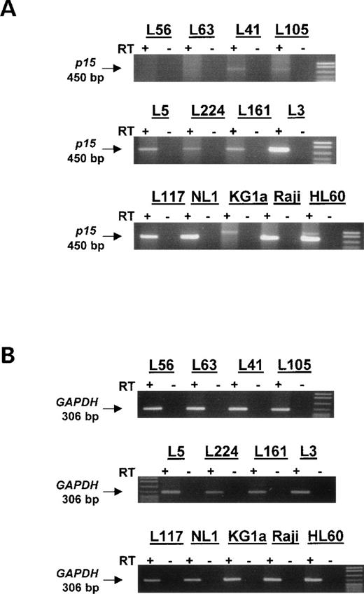 Fig. 3. RT-PCR for primary acute leukemias, leukemia cell lines, and normal lymphocytes. Total cellular RNA was recovered from 9 of the sequenced primary acute leukemias in addition to RNA from 3 leukemia cell lines and normal lymphocytes. RT-PCR for p15 was performed to assess transcription in these samples. p15 expression was found to correlate with density of methylation and with the presence of completely unmethylated alleles in a population. KG1a, which does not express p15,6 has a nonspecific PCR product of a size not matching p15. The control GAPDH RT-PCR was done using low cycle number (20 cycles) and is shown below demonstrating that intact and relatively equal RNA was used for each sample. (+) Indicates the addition of MMLV RT enzyme; (−) indicates control RT reaction to which RT enzyme was not added. The size of p15 product is 450 bp and the size of GAPDH product is 306 bp.
