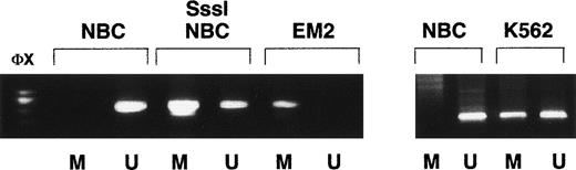 Fig. 2. Methylation-specific PCR shows ABL1 methylation patterns in CML cell lines. NBC, normal donor buffy-coat DNA; SssI-NBC, normal donor buffy-coat DNA treated in vitro with CpG methylase (SssI methylase); EM2, DNA from CML cell line EM2 containing only a duplicate of the Ph′ chromosome and lacking a normal homologue of chromosome 9; K562, DNA from cell line K562 which contains 3 copies of the Ph′ chromosome in addition to a chromosome 9 homologue; M, primers specific for methylated DNA; U, primers specific for unmethylated DNA; ◊x, ◊x/HaeIII marker.