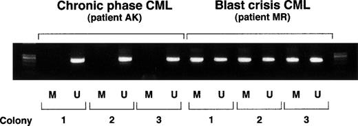 Fig. 4. ABL1 methylation-specific PCR on individual colonies. Each colony was split in half and used for methylation-specific PCR employing primers specific for methylated DNA (M) or for unmethylated DNA (U).